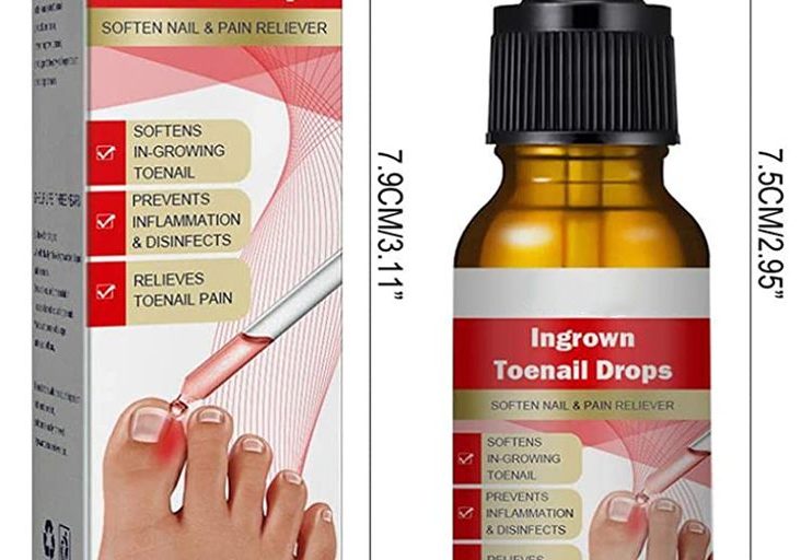 ingrown toenail treatment